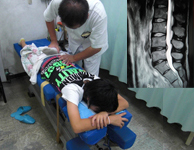 L4L5MRI検査にてヘルニア確認(Dr委任)