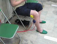 サッカーにより前十字靭帯断裂後のリハビリ中